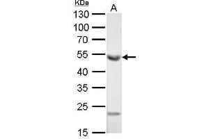 WB Image ALDH1A1 antibody [C3], C-term detects ALDH1A1 protein by Western blot analysis. (ALDH1A1 抗体  (C-Term))