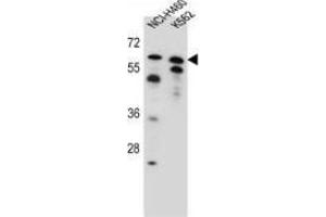 Western blot analysis in NCI-H460, K562 cell line lysates (35ug/lane) using PLAG1  Antibody (N-term). (PLAG1 抗体  (N-Term))