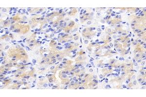 Detection of ACVR2A in Human Stomach Tissue using Monoclonal Antibody to Activin A Receptor Type II A (ACVR2A)