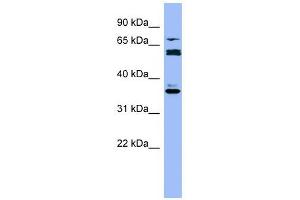 CYP2B6 antibody used at 1 ug/ml to detect target protein. (CYP2B6 抗体  (Middle Region))