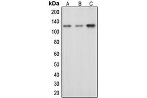 Western blot analysis of c-CBL (pY674) expression in HeLa EGF-treated (A), mouse liver (B), rat liver (C) whole cell lysates. (CBL 抗体  (pTyr674))