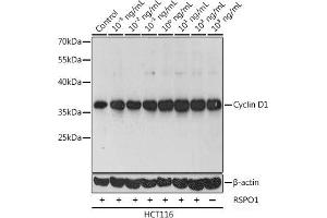 Western blot analysis of extracts of HCT116 cells using Cyclin D1 Polyclonal Antibody at dilution of 1:1000. (Cyclin D1 抗体)