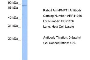 Western Blotting (WB) image for anti-Polyribonucleotide Nucleotidyltransferase 1 (PNPT1) (Middle Region) antibody (ABIN2776602) (PNPT1 抗体  (Middle Region))