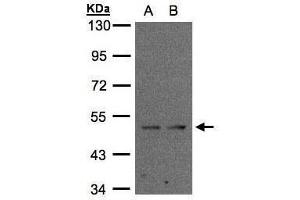 WB Image Sample(30 ug whole cell lysate) A:MOLT4 , B:Raji , 10% SDS PAGE antibody diluted at 1:2000 (IFRD1 抗体)