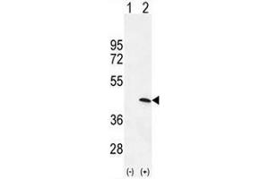Western blot analysis of PRKAG1 (arrow) using rabbit polyclonal PRKAG1 Antibody (N-term) . (PRKAG1 抗体  (N-Term))