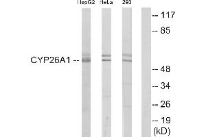 Western blot analysis of extracts from HepG2 cells, HeLa cells and 293 cells, using Cytochrome P450 26A1 antibody. (CYP26A1 抗体)