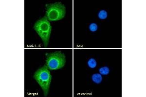 (ABIN570987) Immunofluorescence analysis of paraformaldehyde fixed A431 cells, permeabilized with 0. (IL-18 抗体  (Internal Region))