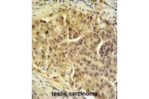 Immunohistochemistry (IHC) image for anti-Cell Division Cycle 45 Homolog (S. Cerevisiae) (CDC45) antibody (ABIN3004359) (CDC45 抗体)