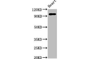 Western Blot Positive WB detected in: Rat heart tissue All lanes: GRM2 antibody at 5 μg/mL Secondary Goat polyclonal to rabbit IgG at 1/50000 dilution Predicted band size: 96 kDa Observed band size: 96 kDa (GRM2 抗体  (AA 93-221))