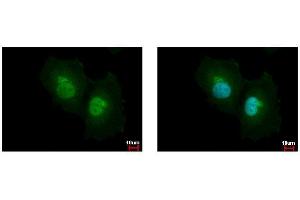 ICC/IF Image ASL antibody detects ASL protein at cytoplasm and nucleus by immunofluorescent analysis. (ASL 抗体)