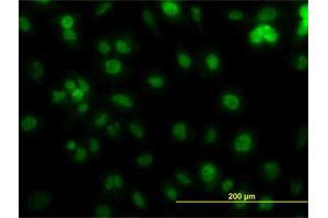 Immunofluorescence (IF) image for anti-Proliferating Cell Nuclear Antigen (PCNA) (AA 1-261) antibody (ABIN562135)