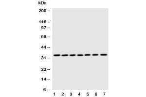 Western blot testing of DCI antibody and Lane 1:  rat liver