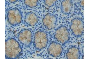 Detection of TFF3 in Human Intestine Tissue using Polyclonal Antibody to Trefoil Factor 3 (TFF3) (TFF3 抗体  (AA 22-80))