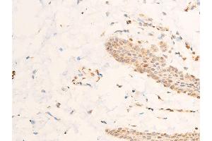ABIN6267218 at 1/100 staining human skin tissue sections by IHC-P. (SGK1 抗体  (pSer422))