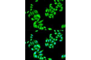 Immunofluorescence analysis of HeLa cells using IKBKB antibody. (IKBKB 抗体)