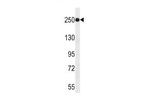 JARID1A Antibody (C-term) (ABIN656192 and ABIN2843346) western blot analysis in uterus tumor cell line lysates (35 μg/lane). (KDM5A 抗体  (C-Term))