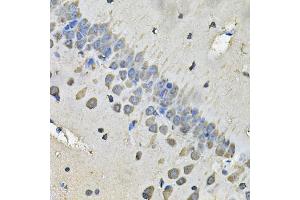 Immunohistochemistry of paraffin-embedded rat brain using MYH1 Antibody (ABIN5974170) at dilution of 1/100 (40x lens). (MYH1 抗体)