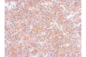 Immunohistochemistry (IHC) image for anti-Echinoderm Microtubule Associated Protein Like 1 (EML1) (C-Term) antibody (ABIN2854673)
