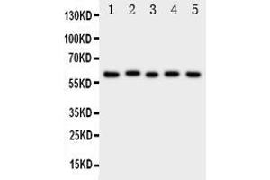 Western blot analysis of ASIC3 using anti- ASIC3 antibody . (ASIC3 抗体  (N-Term))