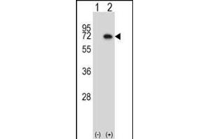 Western Blotting (WB) image for anti-Mitogen-Activated Protein Kinase Kinase Kinase 7 (MAP3K7) (AA 131-160), (N-Term) antibody (ABIN657840)