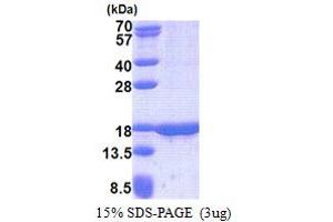 SDS-PAGE (SDS) image for Tumor Suppressor Candidate 2 (TUSC2) (AA 1-110) protein (His tag) (ABIN5853200) (TUSC2 Protein (AA 1-110) (His tag))