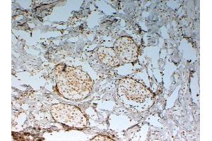 Immunohistochemistry (IHC) image for anti-Forkhead Box C2 (MFH-1, Mesenchyme Forkhead 1) (FOXC2) (C-Term) antibody (ABIN185029)
