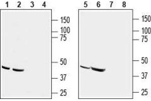 Western blot analysis of human acute T cell leukemia (Jurkat) (lanes 1 and 3), human melanoma (MALME-3M) (lanes 2 and 4), human adenocarcinoma (HT-29) (lanes 5 and 7) and mouse T-cell lymphoma (TK-1) (lanes 6 and 8) cell line lysates: - 1,2,5,6. (CCR9 抗体  (2nd Extracellular Loop))