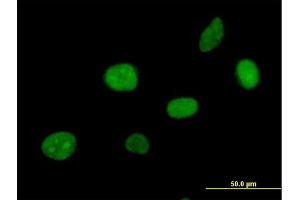 Immunofluorescence of purified MaxPab antibody to APEX2 on HeLa cell. (APEX2 抗体  (AA 1-518))