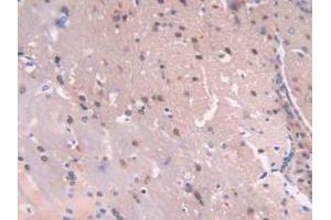 IHC-P analysis of Mouse Brain Tissue, with DAB staining. (C6orf150 抗体  (AA 211-395))