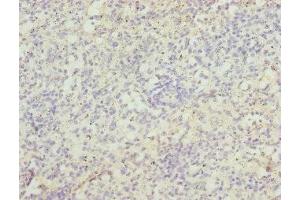 Immunohistochemistry of paraffin-embedded human spleen tissue using ABIN7171726 at dilution of 1:100 (ZBTB48 抗体  (AA 1-280))