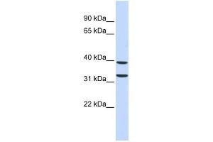 WB Suggested Anti-ZNF177 Antibody Titration:  0. (ZNF177 抗体  (Middle Region))