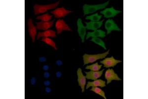 IRAK1 Mouse Monoclonal Antibody staining Hela cells by IF/ICC. (IRAK1 抗体  (Internal Region))
