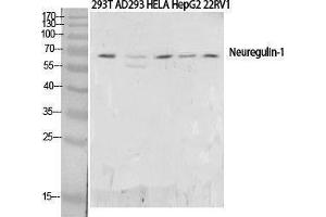 Western Blotting (WB) image for anti-Neuregulin 1 (NRG1) (N-Term) antibody (ABIN3178349) (Neuregulin 1 抗体  (N-Term))