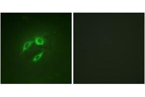 Immunofluorescence analysis of A549 cells, using SEK1/MKK4/JNKK1 (Ab-257) Antibody. (MAP2K4 抗体  (AA 223-272))