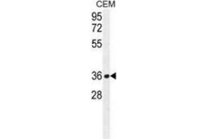 Western blot analysis in CEM cell line lysates (35ug/lane) using NUDT22  Antibody (C-term. (NUDT22 抗体  (C-Term))