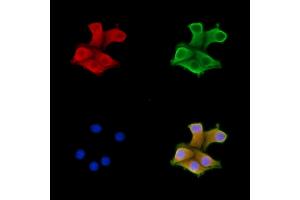 ABIN6257393 and ABIN6274181 staining Hela cells by IF/ICC.
