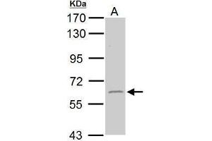 WB Image Sample (50 ug of whole cell lysate) A: mouse brain 7. (GAD65 抗体  (C-Term))