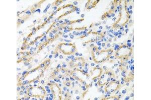 Immunohistochemistry (Paraffin-embedded Sections) (IHC (p)) image for anti-Interleukin-1 Receptor-Associated Kinase 2 (IRAK2) antibody (ABIN7010215)