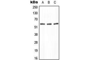 Western blot analysis of PPP2R5A expression in HeLa (A), NIH3T3 (B), H9C2 (C) whole cell lysates. (PPP2R5A 抗体  (Center))