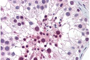 anti-Mediator Complex Subunit 26 (MED26) (AA 501-601) antibody