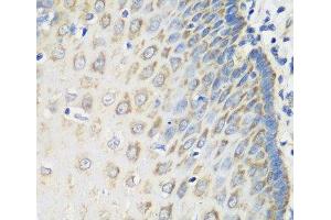Immunohistochemistry of paraffin-embedded Human esophagus using MSRB2 Polyclonal Antibody at dilution of 1:100 (40x lens). (MSRB2 抗体)