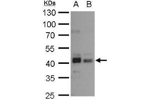 WB Image Bmi1 antibody detects Bmi1 protein by western blot analysis. (BMI1 抗体  (Center))