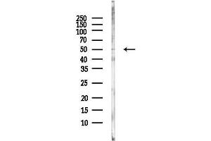 anti-Serotonin Receptor 3B (HTR3B) (C-Term) antibody