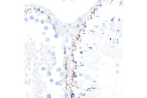 Immunohistochemistry of paraffin-embedded rat testis using γ-Catenin Rabbit mAb (ABIN1683043, ABIN3018625, ABIN3018626 and ABIN7101634) at dilution of 1:100 (40x lens). (JUP 抗体)
