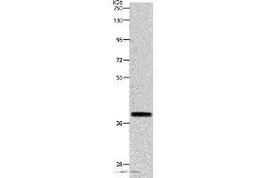 Western blot analysis of RAW264. (Reticulon 4 抗体)