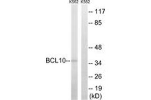 Western blot analysis of extracts from K562 cells, using BCL10 Antibody. (BCL10 抗体  (AA 111-160))