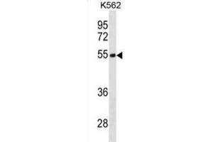 Western Blotting (WB) image for anti-Testis Derived Transcript (3 LIM Domains) (TES) antibody (ABIN3001230)