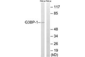Western blot analysis of extracts from HeLa cells, using G3BP-1 (Ab-232) Antibody.