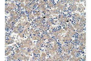 C3ORF10 antibody was used for immunohistochemistry at a concentration of 4-8 ug/ml to stain Hepatocytes (arrows) in Human Liver.