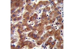 Androgen Receptor antibody (ANDR) immunohistochemistry analysis in formalin fixed and paraffin embedded human liver tissue. (Androgen Receptor 抗体  (AA 365-392))